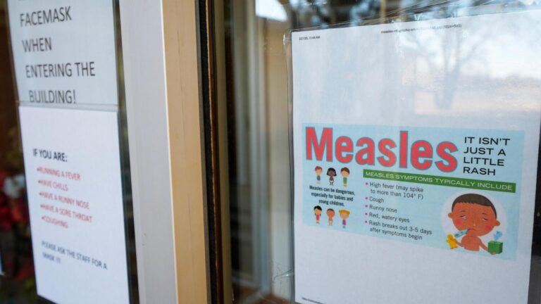 US measles cases hit highest number in 33 years, CDC data shows